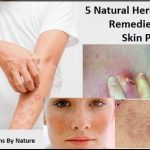 How to use herbal remedies for skin conditions