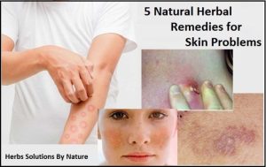 How to use herbal remedies for skin conditions
